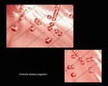 listeria monocytogenes